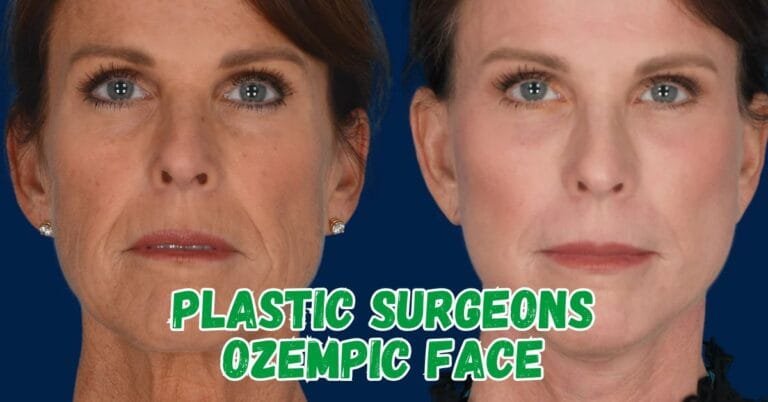 Plastic Surgeons Ozempic Face: Causes, Symptoms & Solutions Plastic Surgeons Ozempic Face